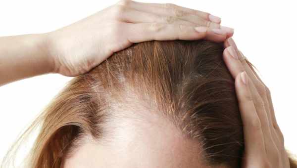 Алопеція: причини та лікування осередку і тотального облисіння у дітей, профілактика випадання волосся